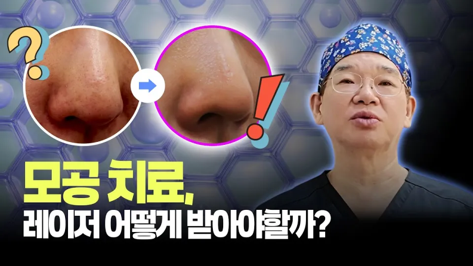 코모공관리는 레이저 조합으로 효과적으로 해결하는 방법