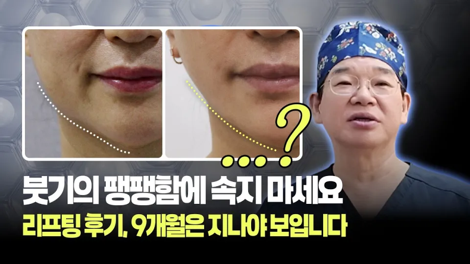 리프팅시술 효과와 과정 복합시술과 줄기세포 활용법