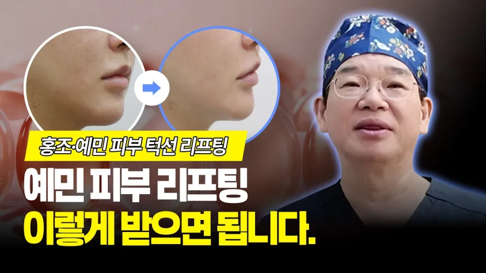 예민피부도 리프팅 시술을 받을 수 있는 방법은 무엇일까